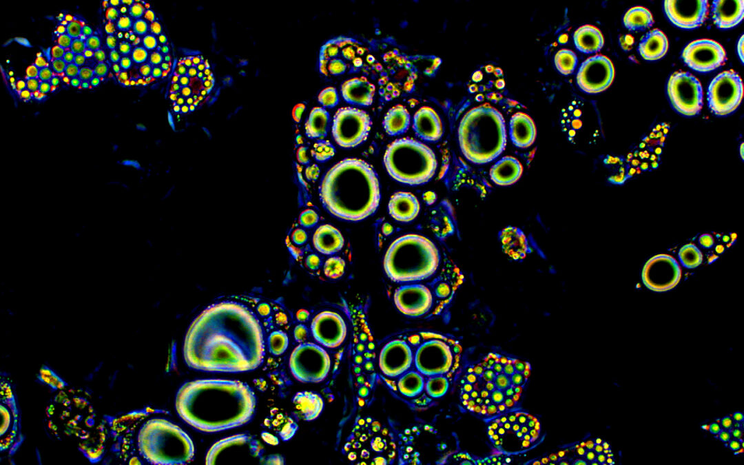 PRIMERA REPARACIÓN CORNEAL  CON CÉLULAS MADRE “REPROGRAMADAS”