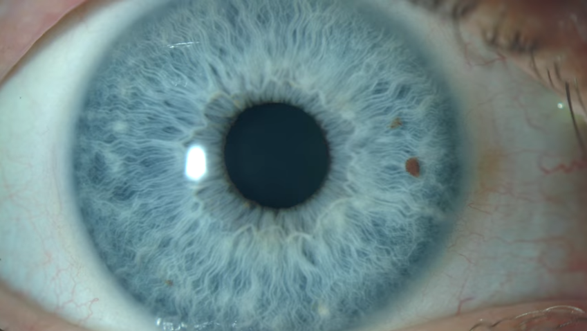 NUEVO DISPOSITIVO DE RASTREO OCULAR  CON POTENCIAL PARA EL DIAGNÓSTICO DEL PARKINSON