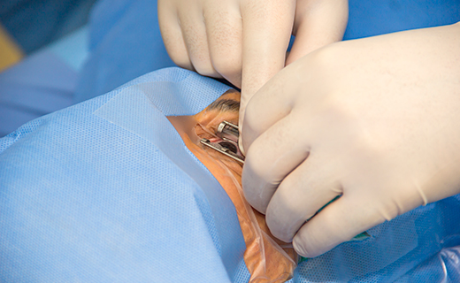 LIO EDOF: MAYOR PROFUNDIDAD DE ENFOQUE