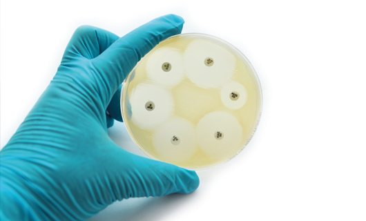 NETILMICINA: UNA CORRECTA ELECCIÓN